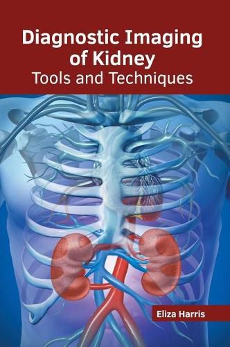 Cover image for Diagnostic Imaging of Kidney: Tools and Techniques