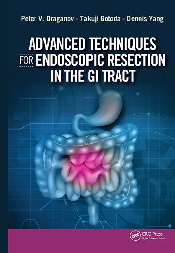 Advanced Techniques for Endoscopic Resection in the GI Tract