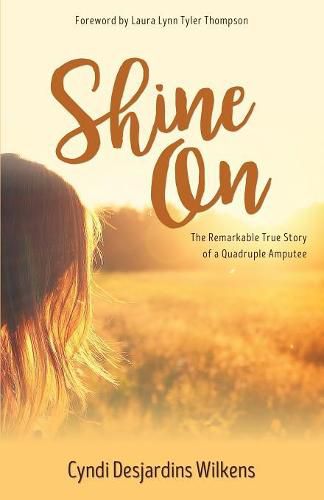 Cover image for Shine On: The Remarkable True Story of a Quadruple Amputee