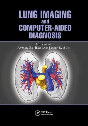 Cover image for Lung Imaging and Computer Aided Diagnosis