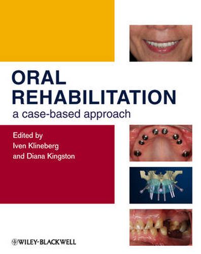 Cover image for Oral Rehabilitation: A Case-based Approach