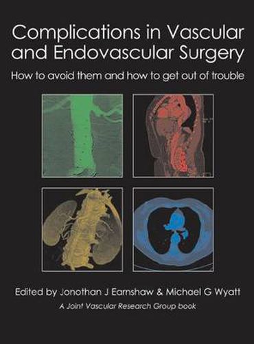 Cover image for Complications in Vascular & Endovascular Surgery: How to Avoid Them & How to Get Out of Trouble
