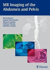 Cover image for MR Imaging of the Abdomen and Pelvis