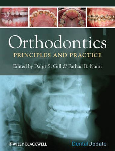 Cover image for Orthodontics: Principles and Practice