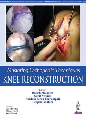 Cover image for Mastering Orthopedic Techniques: Knee Reconstruction