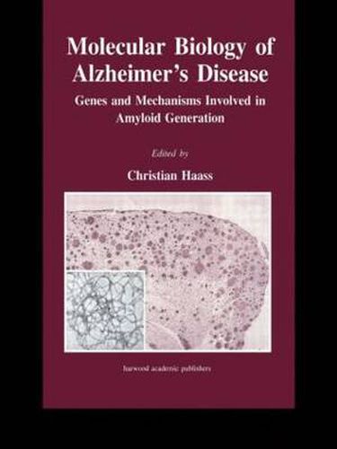 Cover image for Molecular Biology of Alzheimer's Disease: Genes and Mechanisms Involved in Amyloid Generation