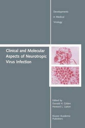 Cover image for Clinical and Molecular Aspects of Neurotropic Virus Infection