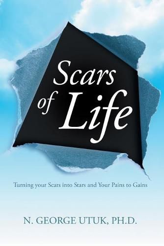 Cover image for Scars of Life: Turning your Scars into Stars and Your Pains to Gains