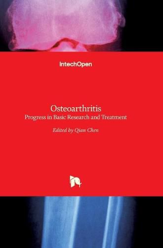 Cover image for Osteoarthritis: Progress in Basic Research and Treatment