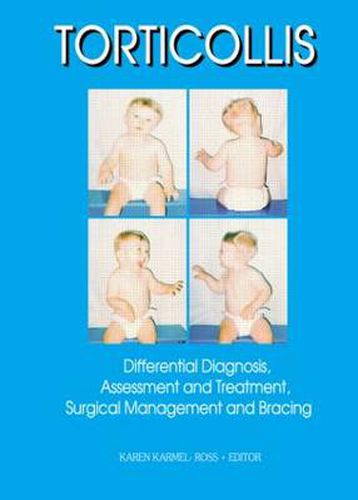 Cover image for Torticollis: Differential Diagnosis, Assessment and Treatment, Surgical Management and Bracing