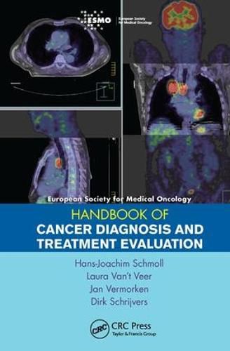 Cover image for ESMO Handbook of Cancer Diagnosis and Treatment Evaluation