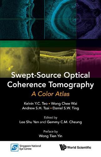 Swept-source Optical Coherence Tomography: A Color Atlas