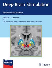 Cover image for Deep Brain Stimulation: Techniques and Practices