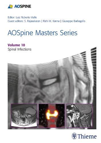 Cover image for AOSpine Masters Series, Volume 10: Spinal Infections