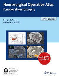 Cover image for Neurosurgical Operative Atlas: Functional Neurosurgery