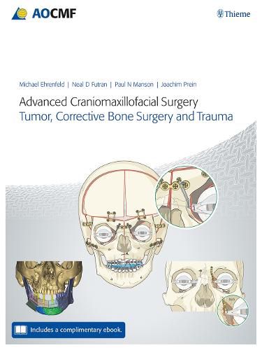 Cover image for Advanced Craniomaxillofacial Surgery: Tumor, Corrective Bone Surgery, and Trauma