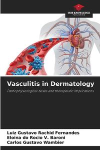 Cover image for Vasculitis in Dermatology