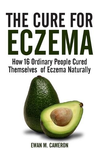 Cover image for The Cure for Eczema