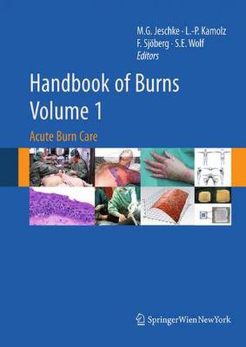 Handbook of Burns Volume 1: Acute Burn Care