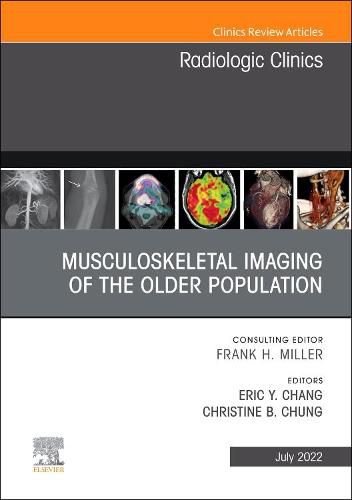 Cover image for Musculoskeletal Imaging of the Older Population, An Issue of Radiologic Clinics of North America