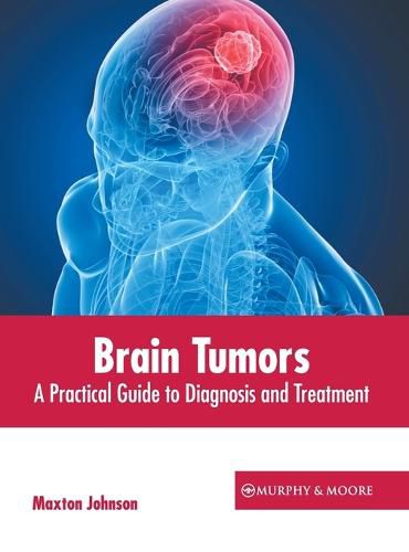 Brain Tumors: A Practical Guide to Diagnosis and Treatment