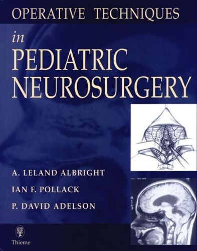 Cover image for Operative Techniques in Pediatric Neurosurgery