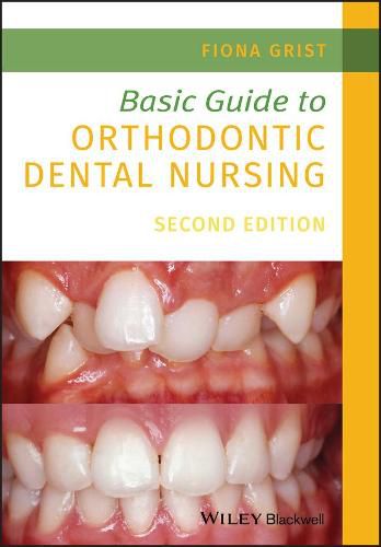 Cover image for Basic Guide to Orthodontic Dental Nursing 2nd Edition