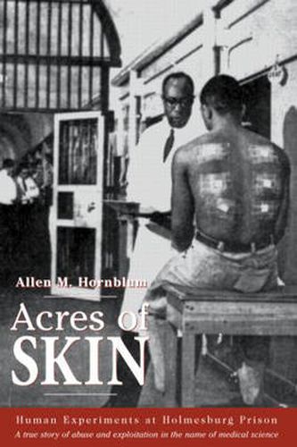 Cover image for Acres of Skin: Human Experiments at Holmesburg Prison