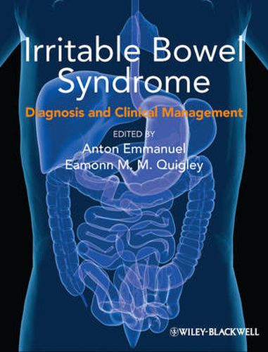 Cover image for Irritable Bowel Syndrome: Diagnosis and Clinical Management