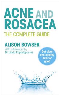 Cover image for Acne and Rosacea: The Complete Guide