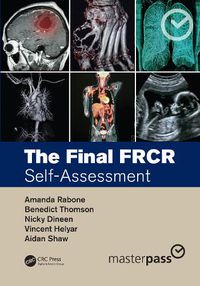 Cover image for The Final FRCR: Self-Assessment