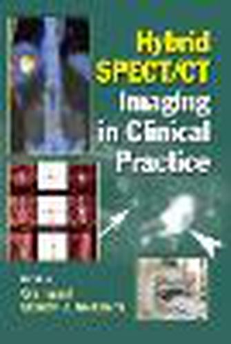 Cover image for Hybrid SPECT/CT Imaging in Clinical Practice