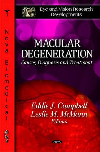 Macular Degeneration: Causes, Diagnosis & Treatment