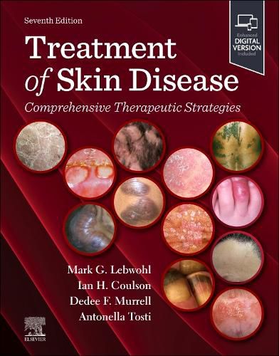 Cover image for Treatment of Skin Disease: Comprehensive Therapeutic Strategies