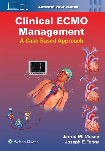 Cover image for Clinical ECMO Management