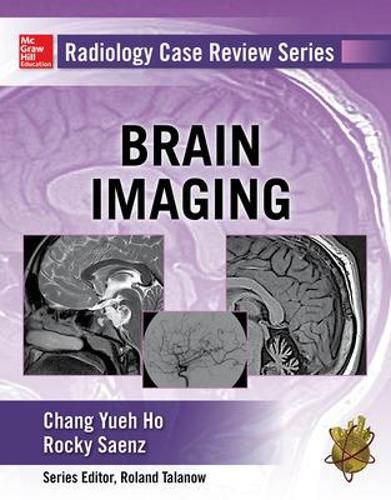 Cover image for Radiology Case Review Series: Brain Imaging