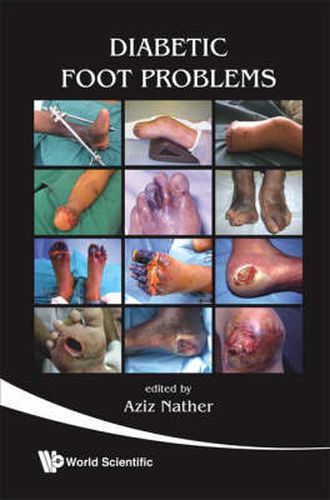 Cover image for Diabetic Foot Problems