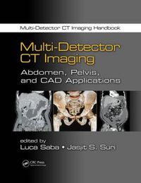 Cover image for Multi-Detector CT Imaging: Abdomen, Pelvis, and CAD Applications