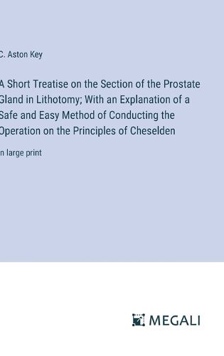 Cover image for A Short Treatise on the Section of the Prostate Gland in Lithotomy; With an Explanation of a Safe and Easy Method of Conducting the Operation on the Principles of Cheselden