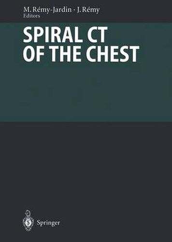 Cover image for Spiral CT of the Chest