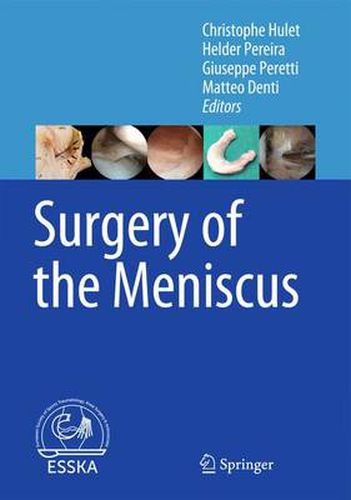 Cover image for Surgery of the Meniscus