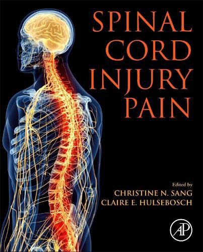 Cover image for Spinal Cord Injury Pain