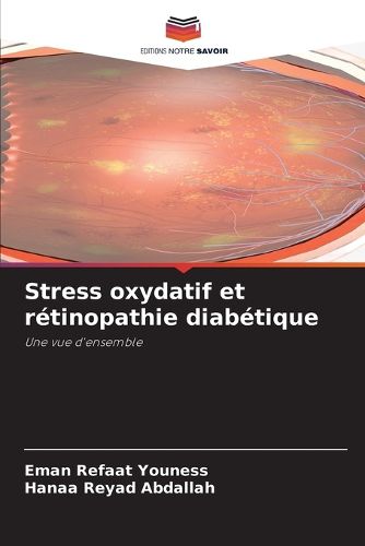 Stress oxydatif et retinopathie diabetique, Eman Refaat Youness, Hanaa ...