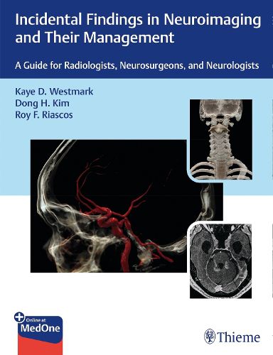 Cover image for Incidental Findings in Neuroimaging and Their Management: A Guide for Radiologists, Neurosurgeons, and Neurologists