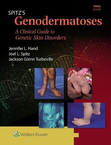 Genodermatoses: A Full Color Clinical Guide to Genetic Skin Disorders