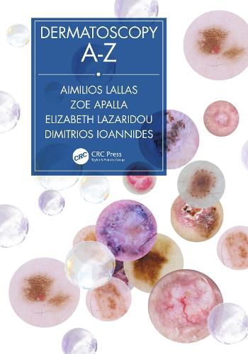 Cover image for Dermatoscopy A-Z