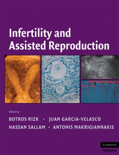 Cover image for Infertility and Assisted Reproduction