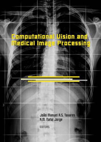 Cover image for Computational Vision and Medical Image Processing: VipIMAGE 2007