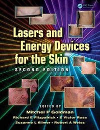 Cover image for Lasers and Energy Devices for the Skin