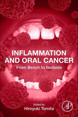 Cover image for Inflammation and Oral Cancer: From Bench to Bedside